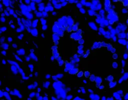 IFN gamma